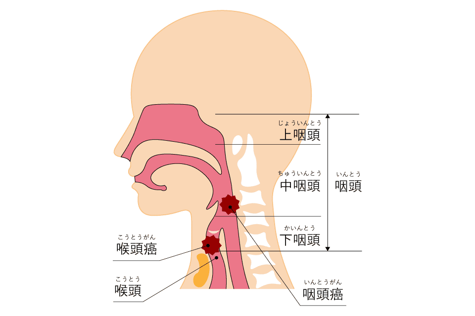 咽頭癌・喉頭癌